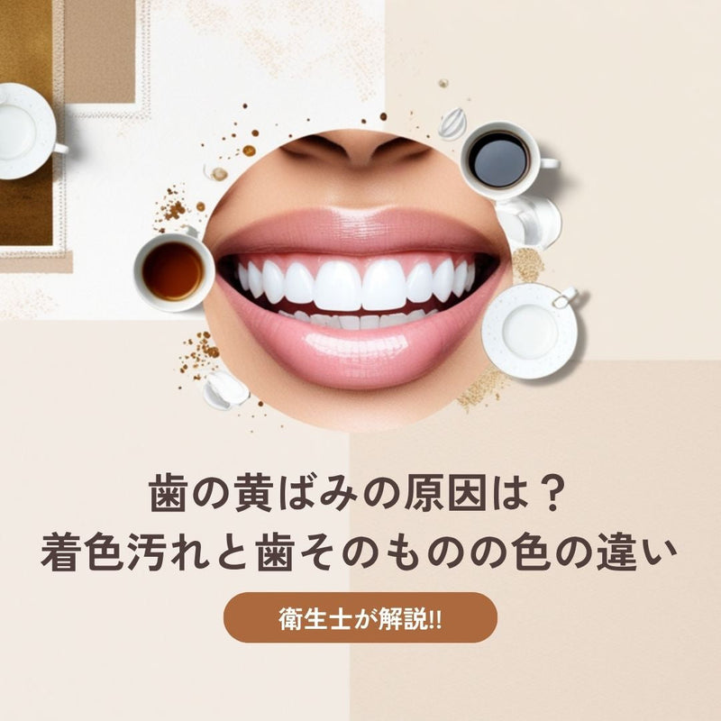歯の黄ばみの原因は？着色汚れと歯そのものの色の違いを衛生士が解説