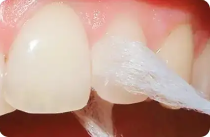 fluorfloss フロアフロス 45ｍ